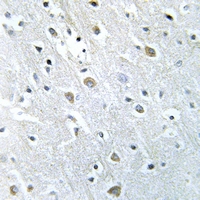 19 - Anti-PIGX Antibody AP59847
