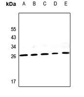 1 - Anti-PIGX Antibody AP59847
