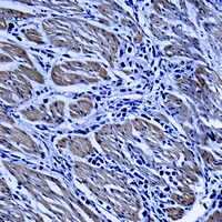 19 - Anti-TRIM68 Antibody AP59848