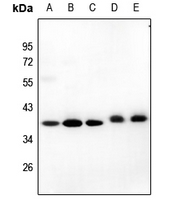 1 - Anti-GIMAP4 Antibody AP59849