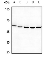 1 - Anti-PPP4R1L Antibody AP59850