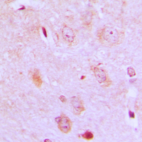 19 - Anti-IARS2 Antibody AP59851