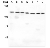 1 - Anti-IARS2 Antibody AP59851