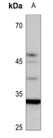 1 - Anti-UBFD1 Antibody AP59853