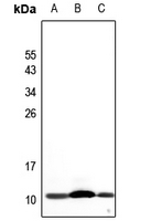 1 - Anti-NDUFA4L2 Antibody AP59855