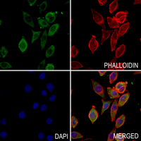 3 - Anti-CHRNA10 Antibody AP59856