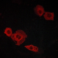 3 - Anti-CYSLTR2 Antibody AP59857