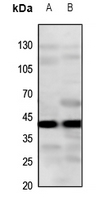 1 - Anti-CYSLTR2 Antibody AP59857
