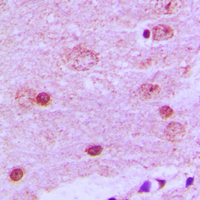 19 - Anti-PAK7 Antibody AP59858