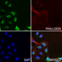 3 - Anti-ARRDC3 Antibody AP59860
