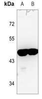 1 - Anti-ARRDC3 Antibody AP59860