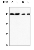 1 - Anti-TRIB3 Antibody AP59861