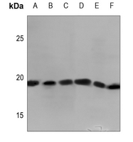 1 - Anti-MYL7 Antibody AP59863