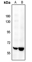 1 - Anti-SENP2 Antibody AP59864