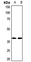 1 - Anti-NIP1 Antibody AP59865
