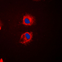 3 - Anti-EPS8L2 Antibody AP59866