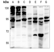 1 - Anti-EPS8L2 Antibody AP59866