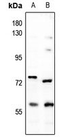 1 - Anti-DCLRE1B Antibody AP59867