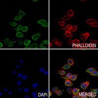 3 - Anti-MRPL14 Antibody AP59869