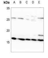 1 - Anti-MRPL14 Antibody AP59869