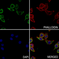3 - Anti-ELOVL6 Antibody AP59871