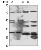 1 - Anti-ELOVL6 Antibody AP59871