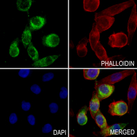 3 - Anti-LASS4 Antibody AP59872