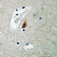 19 - Anti-LASS4 Antibody AP59872