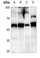 1 - Anti-SUV39H2 Antibody AP59873