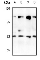 1 - Anti-Rabaptin 5 beta Antibody AP59874