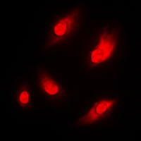 3 - Anti-NAA15 Antibody AP59875
