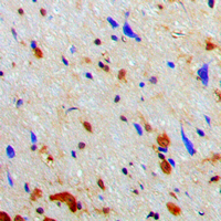 19 - Anti-NAA15 Antibody AP59875