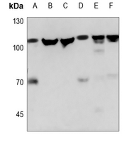 1 - Anti-NAA15 Antibody AP59875