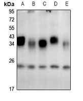 1 - Anti-CSP Antibody AP59876