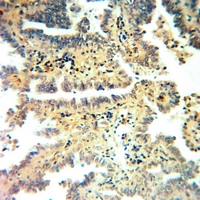 19 - Anti-AARSD1 Antibody AP59877