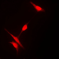3 - Anti-Histone Deacetylase 10 Antibody AP59879