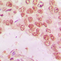 19 - Anti-Histone Deacetylase 10 Antibody AP59879