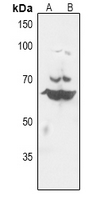 1 - Anti-Histone Deacetylase 10 Antibody AP59879
