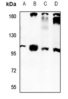 1 - Anti-NaBC1 Antibody AP59880