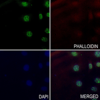 3 - Anti-HORMAD1 Antibody AP59881