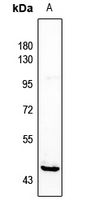 1 - Anti-HORMAD1 Antibody AP59881