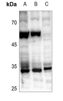 1 - Anti-ZC3H8 Antibody AP59883