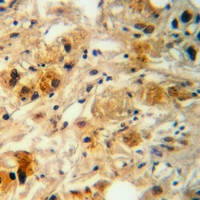 19 - Anti-AGBL4 Antibody AP59885