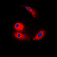3 - Anti-ARMC6 Antibody AP59886