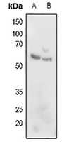 1 - Anti-ARMC6 Antibody AP59886