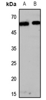 1 - Anti-Melanopsin Antibody AP59887