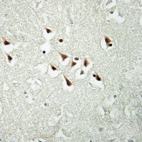 19 - Anti-GPC5 Antibody AP59888