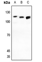 1 - Anti-GPC5 Antibody AP59888
