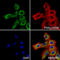 3 - Anti-Caspase 12 Antibody AP59889