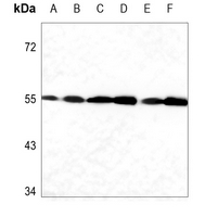 1 - Anti-Caspase 12 Antibody AP59889